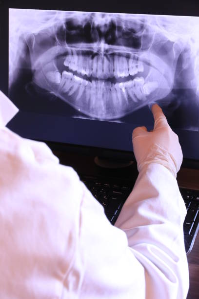 Best Emergency Treatment for Dental Infections or Abscesses in Mount Oliver, PA
