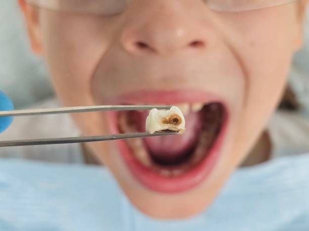 Best Emergency Tooth Extraction in Mount Oliver, PA