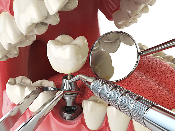 Best Urgent Care for Lost Fillings or Crowns in Mount Oliver, PA